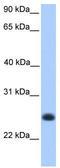 Coiled-Coil Domain Containing 184 antibody, TA334940, Origene, Western Blot image 