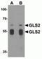 Glutaminase 2 antibody, NBP2-82071, Novus Biologicals, Western Blot image 