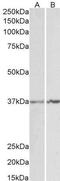 Annexin A1 antibody, GTX88476, GeneTex, Western Blot image 