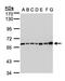 Complement C2 antibody, NBP1-32589, Novus Biologicals, Western Blot image 