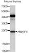 ADP Ribosylation Factor Like GTPase 6 Interacting Protein 5 antibody, LS-C749824, Lifespan Biosciences, Western Blot image 