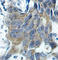 Catenin Beta 1 antibody, AP0216, ABclonal Technology, Immunohistochemistry paraffin image 