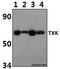TXK Tyrosine Kinase antibody, A06283, Boster Biological Technology, Western Blot image 