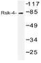 Ribosomal Protein S6 Kinase A6 antibody, AP20537PU-N, Origene, Western Blot image 