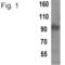 TPX2 Microtubule Nucleation Factor antibody, MA1-802, Invitrogen Antibodies, Western Blot image 