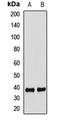 F-Box Protein 2 antibody, LS-C668323, Lifespan Biosciences, Western Blot image 
