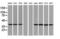 Sterol O-Acyltransferase 2 antibody, LS-C172344, Lifespan Biosciences, Western Blot image 