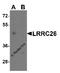 Leucine Rich Repeat Containing 26 antibody, MBS153399, MyBioSource, Western Blot image 