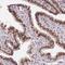 CD2 Cytoplasmic Tail Binding Protein 2 antibody, PA5-63947, Invitrogen Antibodies, Immunohistochemistry frozen image 