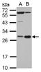 Hematopoietically-expressed homeobox protein HHEX antibody, NBP2-16811, Novus Biologicals, Western Blot image 