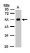 Angiotensinogen antibody, LS-C185567, Lifespan Biosciences, Western Blot image 
