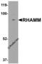 Hyaluronan Mediated Motility Receptor antibody, 6189, ProSci, Western Blot image 