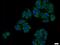 V-type proton ATPase subunit d 1 antibody, 18274-1-AP, Proteintech Group, Immunofluorescence image 