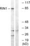 Ras and Rab interactor 1 antibody, LS-C120297, Lifespan Biosciences, Western Blot image 