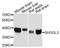 SH3 Domain Containing GRB2 Like 3, Endophilin A3 antibody, A4112, ABclonal Technology, Western Blot image 