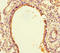 SLIT And NTRK Like Family Member 6 antibody, LS-C397391, Lifespan Biosciences, Immunohistochemistry paraffin image 