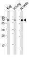 HERV-K_1q22 provirus ancestral Env polyprotein antibody, MBS9216561, MyBioSource, Western Blot image 