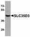 Solute Carrier Family 35 Member D3 antibody, NBP2-81839, Novus Biologicals, Western Blot image 