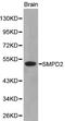 Sphingomyelin Phosphodiesterase 2 antibody, PA5-75990, Invitrogen Antibodies, Western Blot image 