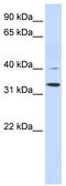 Crystallin Zeta antibody, TA339246, Origene, Western Blot image 