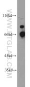 Quiescin Sulfhydryl Oxidase 1 antibody, 12713-1-AP, Proteintech Group, Western Blot image 