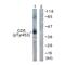 CD5 Molecule antibody, PA5-38449, Invitrogen Antibodies, Western Blot image 