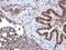 Deoxycytidine kinase antibody, GTX102800, GeneTex, Immunohistochemistry paraffin image 