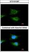 Glucosylceramidase Beta antibody, LS-C185394, Lifespan Biosciences, Immunocytochemistry image 