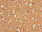 ATPase H+ Transporting V1 Subunit G2 antibody, CSB-PA002409LA01HU, Cusabio, Immunohistochemistry paraffin image 