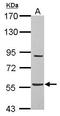 Abhydrolase Domain Containing 16A antibody, LS-C155592, Lifespan Biosciences, Western Blot image 