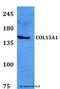 Collagen alpha-1(XV) chain antibody, A05581, Boster Biological Technology, Western Blot image 