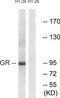 Glucocorticoid receptor antibody, TA313373, Origene, Western Blot image 
