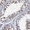 Katanin Catalytic Subunit A1 Like 2 antibody, NBP2-30844, Novus Biologicals, Immunohistochemistry frozen image 