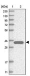 Sulfotransferase Family 1E Member 1 antibody, PA5-55963, Invitrogen Antibodies, Western Blot image 