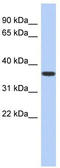 Mevalonate Kinase antibody, TA335150, Origene, Western Blot image 