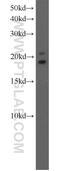 Sperm protein associated with the nucleus on the X chromosome E antibody, 15870-1-AP, Proteintech Group, Western Blot image 