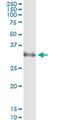 Homeobox protein Hox-A1 antibody, MA5-19111, Invitrogen Antibodies, Immunoprecipitation image 