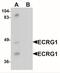 Transmembrane Serine Protease 11A antibody, NBP2-41140, Novus Biologicals, Western Blot image 
