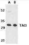 CD267 antibody, SP2135P, Origene, Western Blot image 