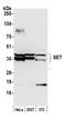 SET Nuclear Proto-Oncogene antibody, A302-261A, Bethyl Labs, Western Blot image 