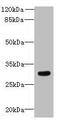 Zinc Finger DHHC-Type Containing 12 antibody, A66298-100, Epigentek, Western Blot image 