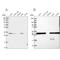Proteasome Subunit Alpha 1 antibody, NBP2-37908, Novus Biologicals, Western Blot image 