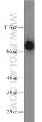 Ras Homolog Family Member T2 antibody, 11237-1-AP, Proteintech Group, Western Blot image 