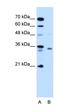 Ras Converting CAAX Endopeptidase 1 antibody, orb325186, Biorbyt, Western Blot image 