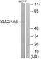 Solute Carrier Family 8 Member B1 antibody, A30764, Boster Biological Technology, Western Blot image 