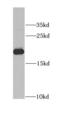 Adenine Phosphoribosyltransferase antibody, FNab00518, FineTest, Western Blot image 
