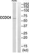BEN Domain Containing 4 antibody, TA316403, Origene, Western Blot image 