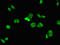 SH2 Domain Containing 1B antibody, orb46087, Biorbyt, Immunofluorescence image 