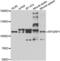 X-linked retinitis pigmentosa GTPase regulator-interacting protein 1 antibody, LS-C349171, Lifespan Biosciences, Western Blot image 