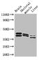 Aldolase, Fructose-Bisphosphate C antibody, LS-C500122, Lifespan Biosciences, Western Blot image 